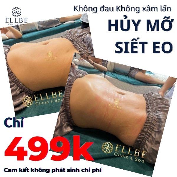 499k – căng da, sạch mỡ