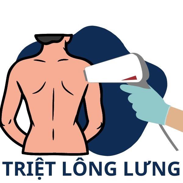 Triệt Lông Lưng 10B