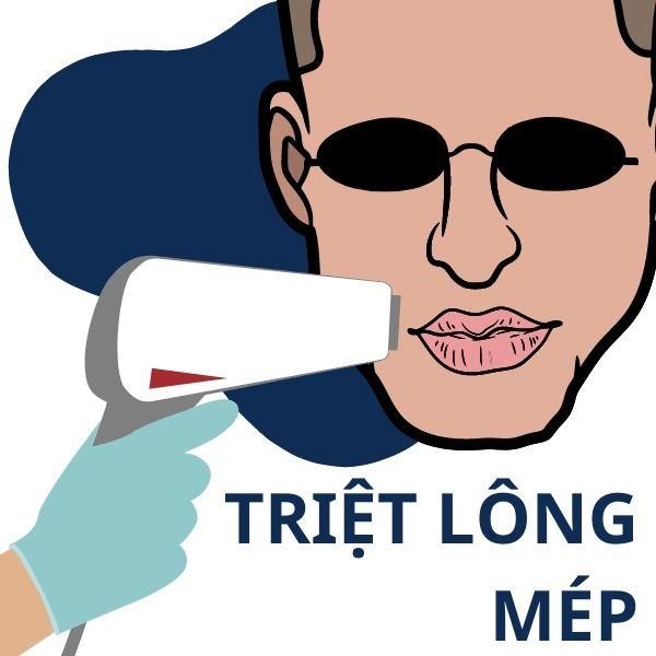 Triệt Lông Mép 10B