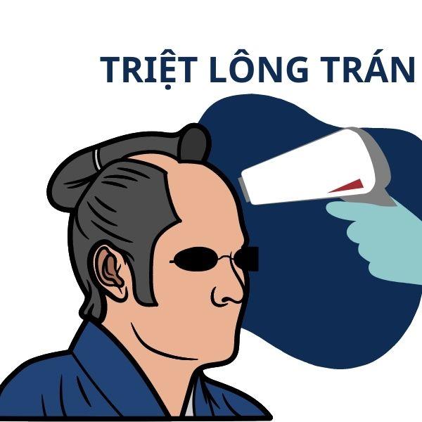 Triệt Lông Trán 10B