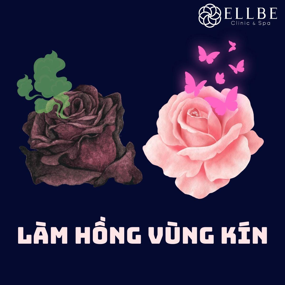 Làm hồng vùng kín Cấp độ 2