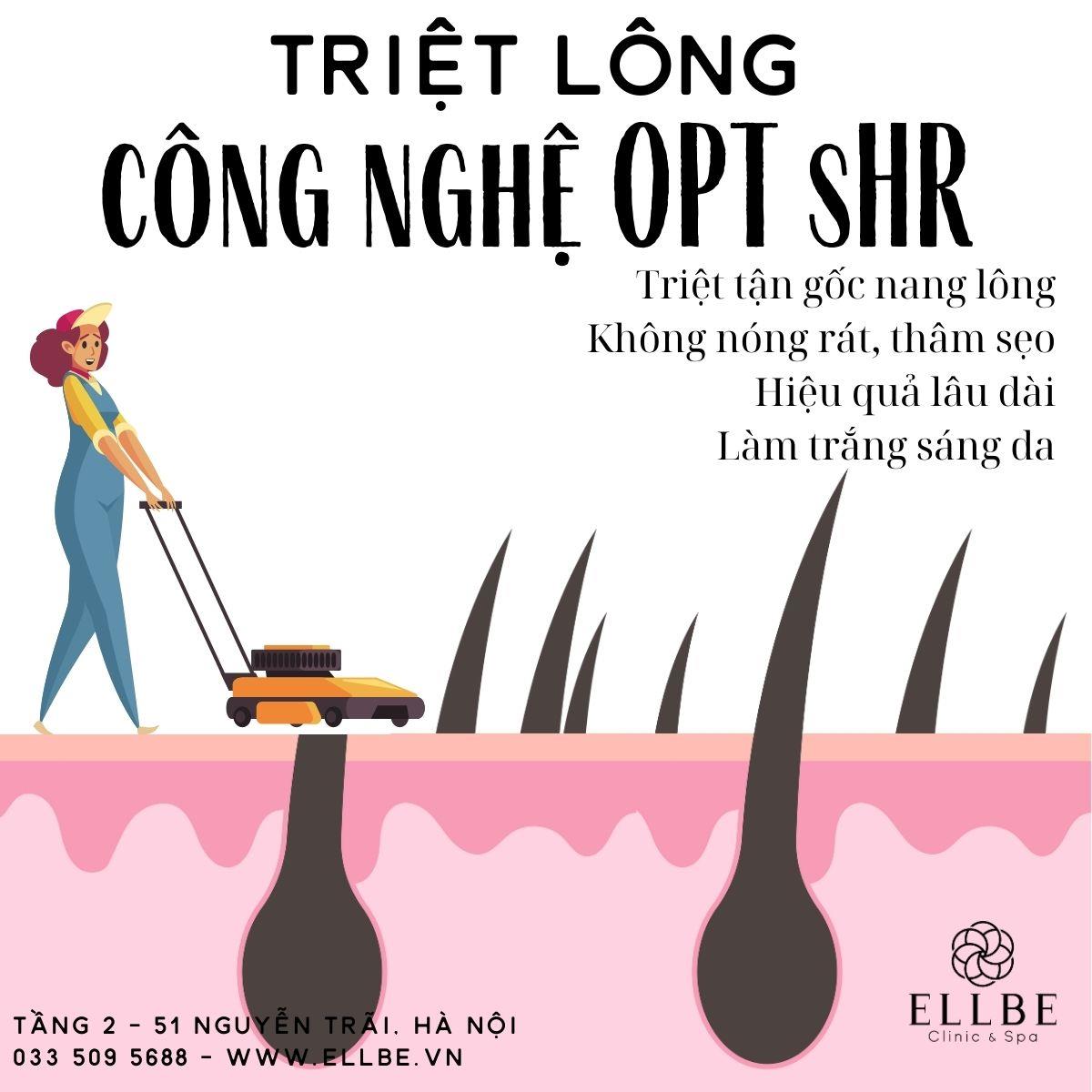 🎀 Triệt Lông OTP SHR - Giải pháp hiện đại cho làn da mịn màng và tự tin!