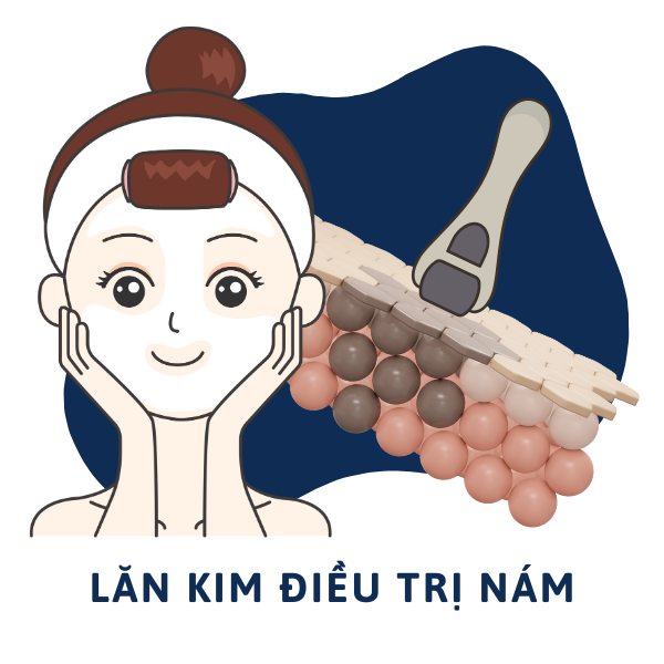Lăn kim điều trị nám
