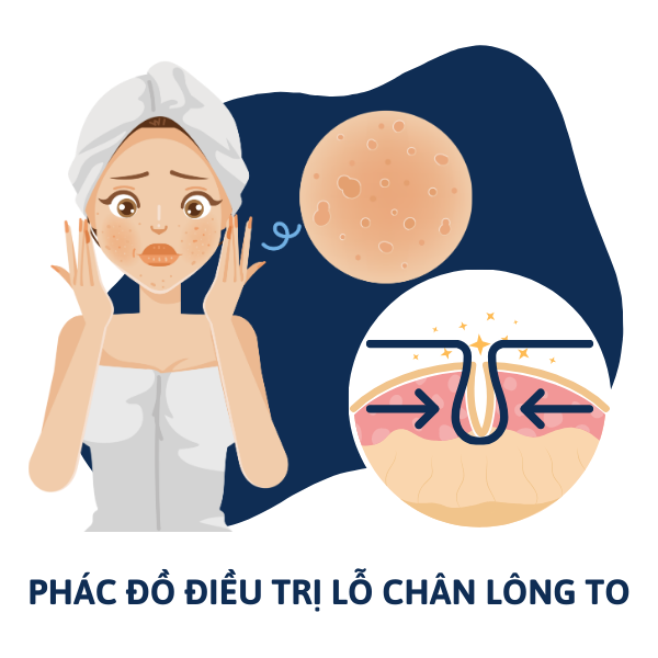 Phác Đồ Điều Trị Lỗ Chân Lông To